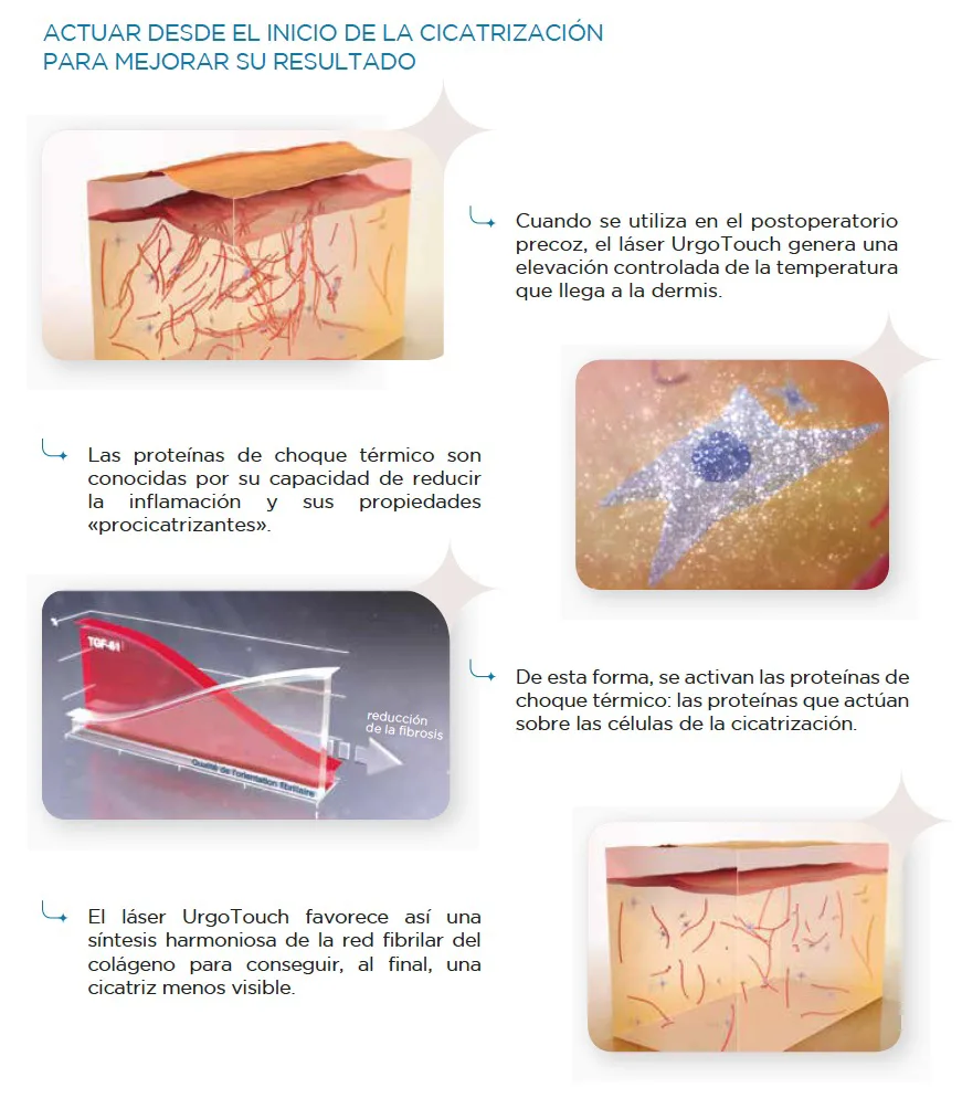 urgotouch2 1 - Dr. Martin Diaz - Cirugía Estética