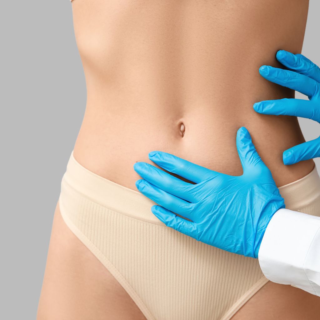 Liposucción de pubis