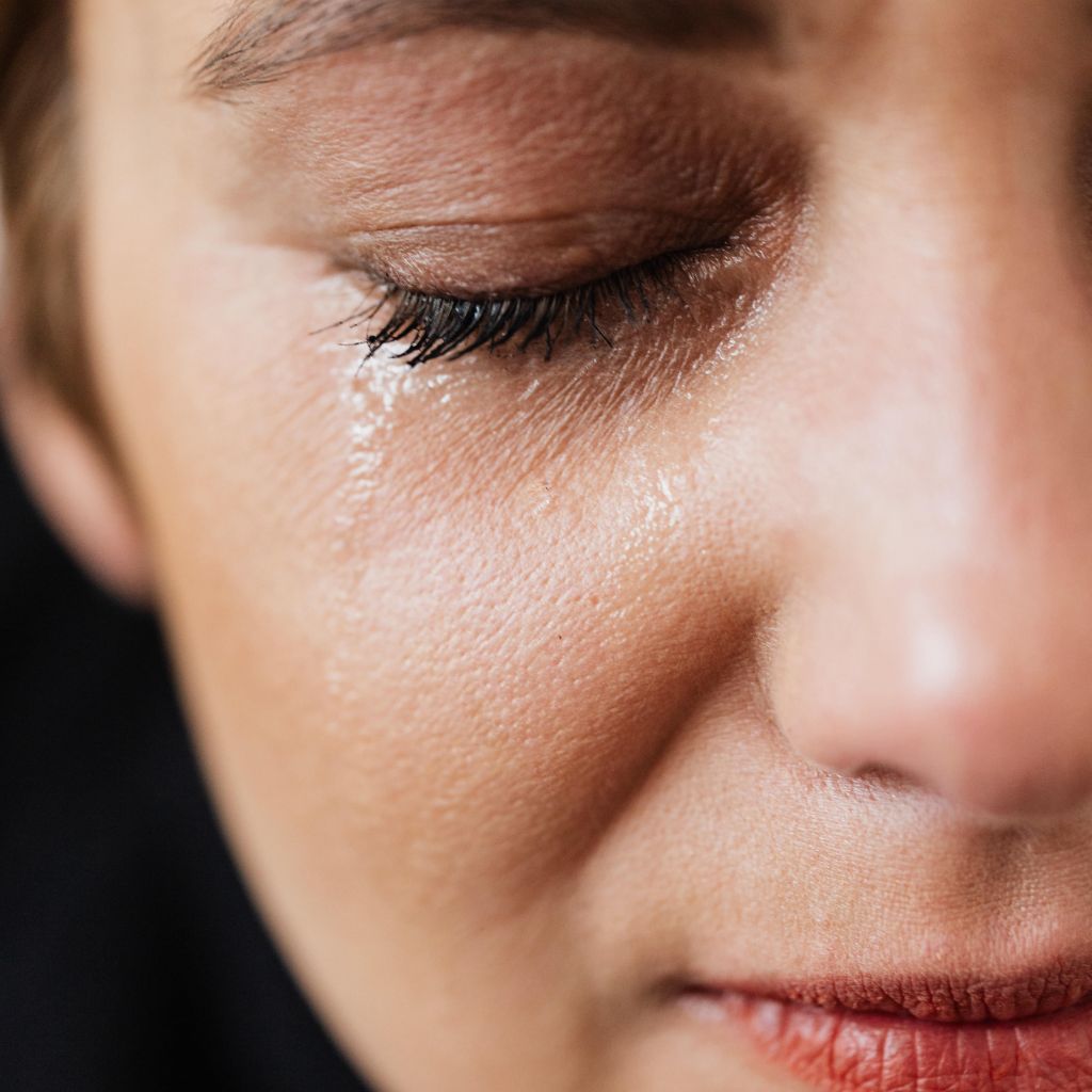 ojos tristes después de blefaroplastia